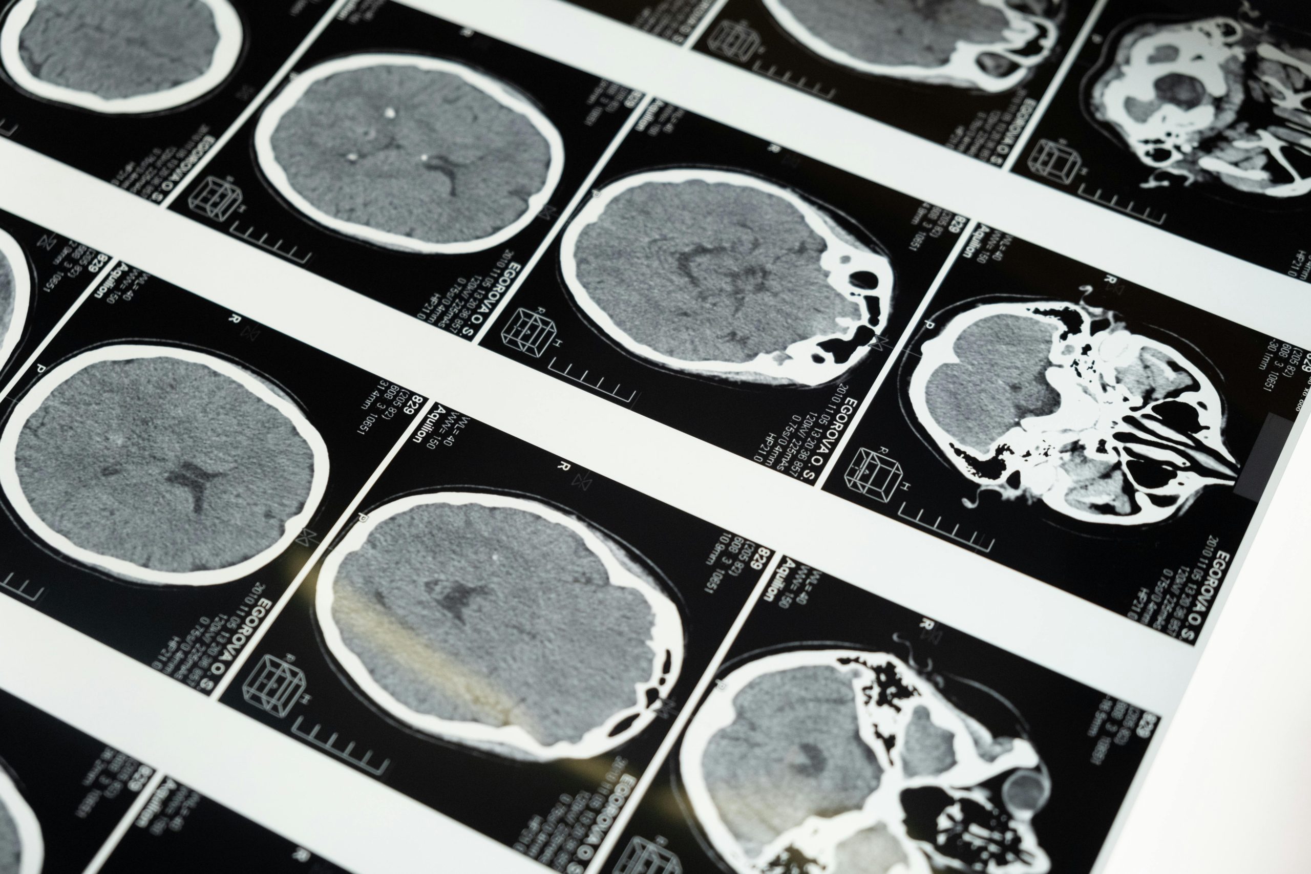 Neurociencia emocional: cómo el cerebro procesa sentimientos y reacciones.